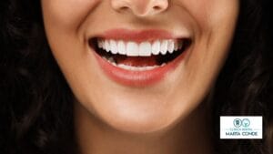 carillas dentales en Boadilla del Monte Madrid
