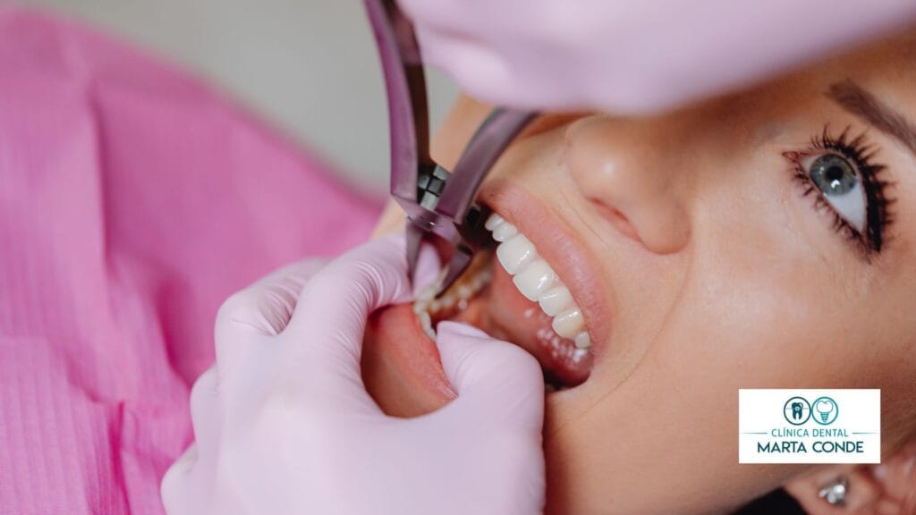 implantes dentales en parla Madrid sur