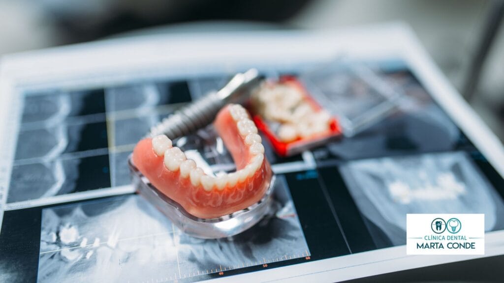 Tratamiento de prótesis dentales en parla