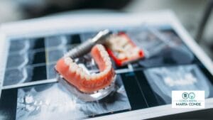 Tratamiento de prótesis dentales en parla